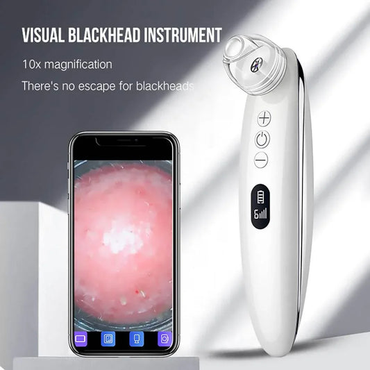 Facial-Blackhead-Remover-Mubimart-3924 - Mubimart