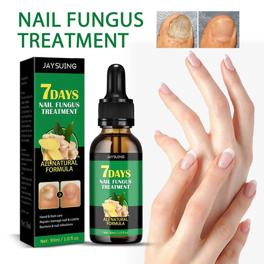 Ginger-Nail-Care-Lotion-Repair-Hand-And-Foot-Moisturizing-Mubimart-8825 - Mubimart