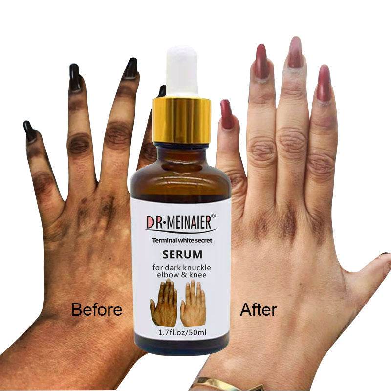Hand Brightening Moisturizing Lotion South Africa India - Mubimart