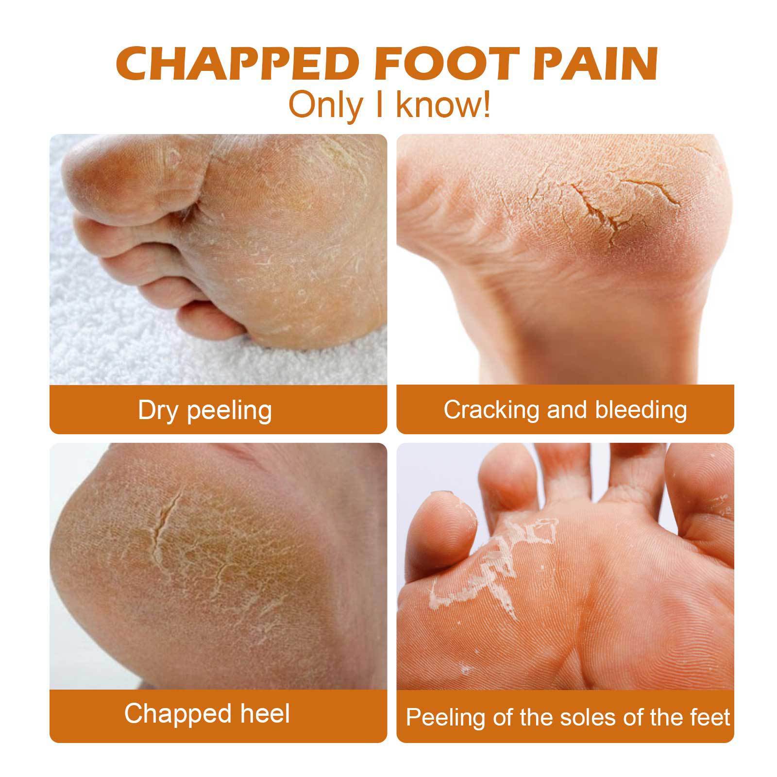 Horse Oil Foot Care Cream Repair Heel Dry Peeling Anti-chapping - Mubimart