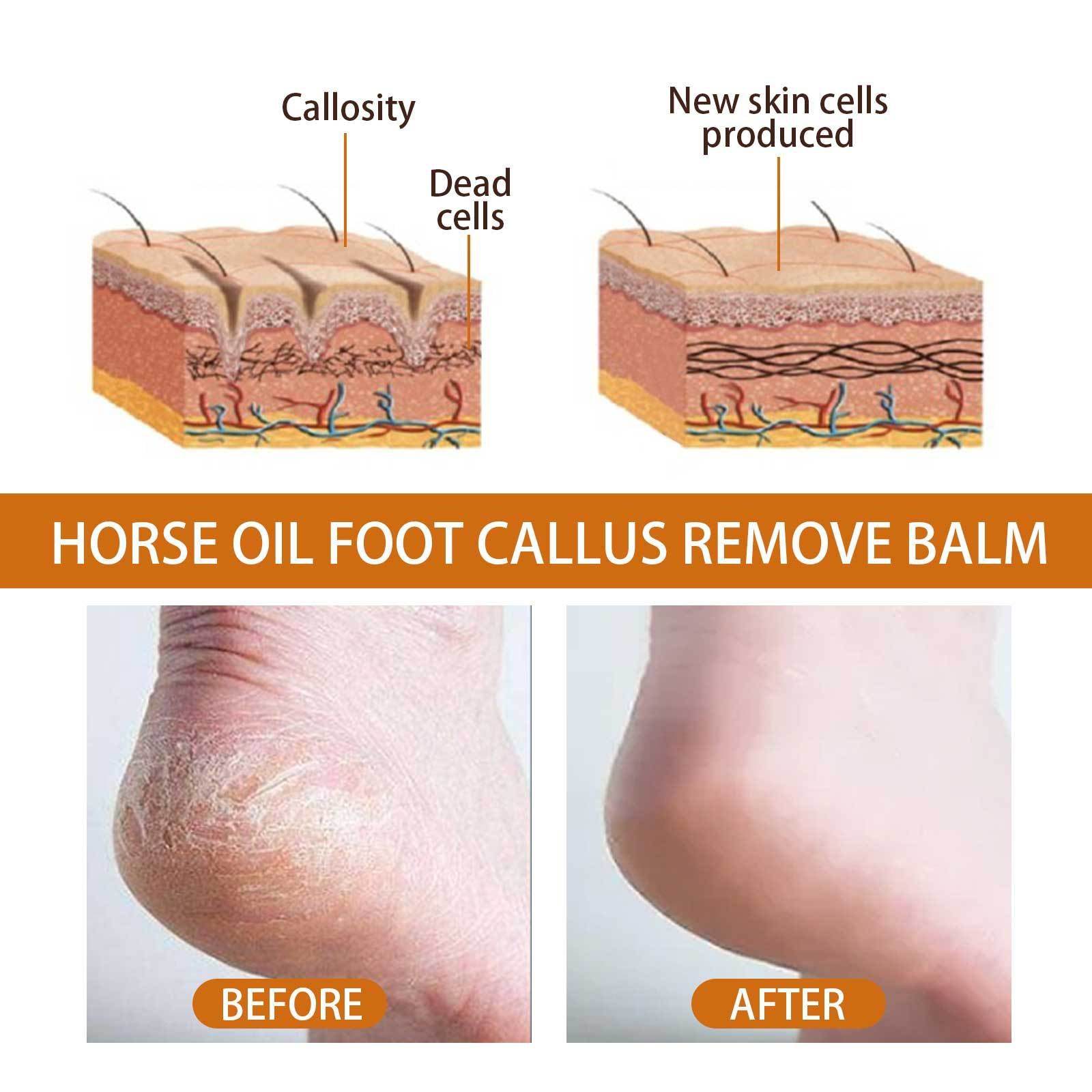 Horse Oil Foot Care Cream Repair Heel Dry Peeling Anti-chapping - Mubimart