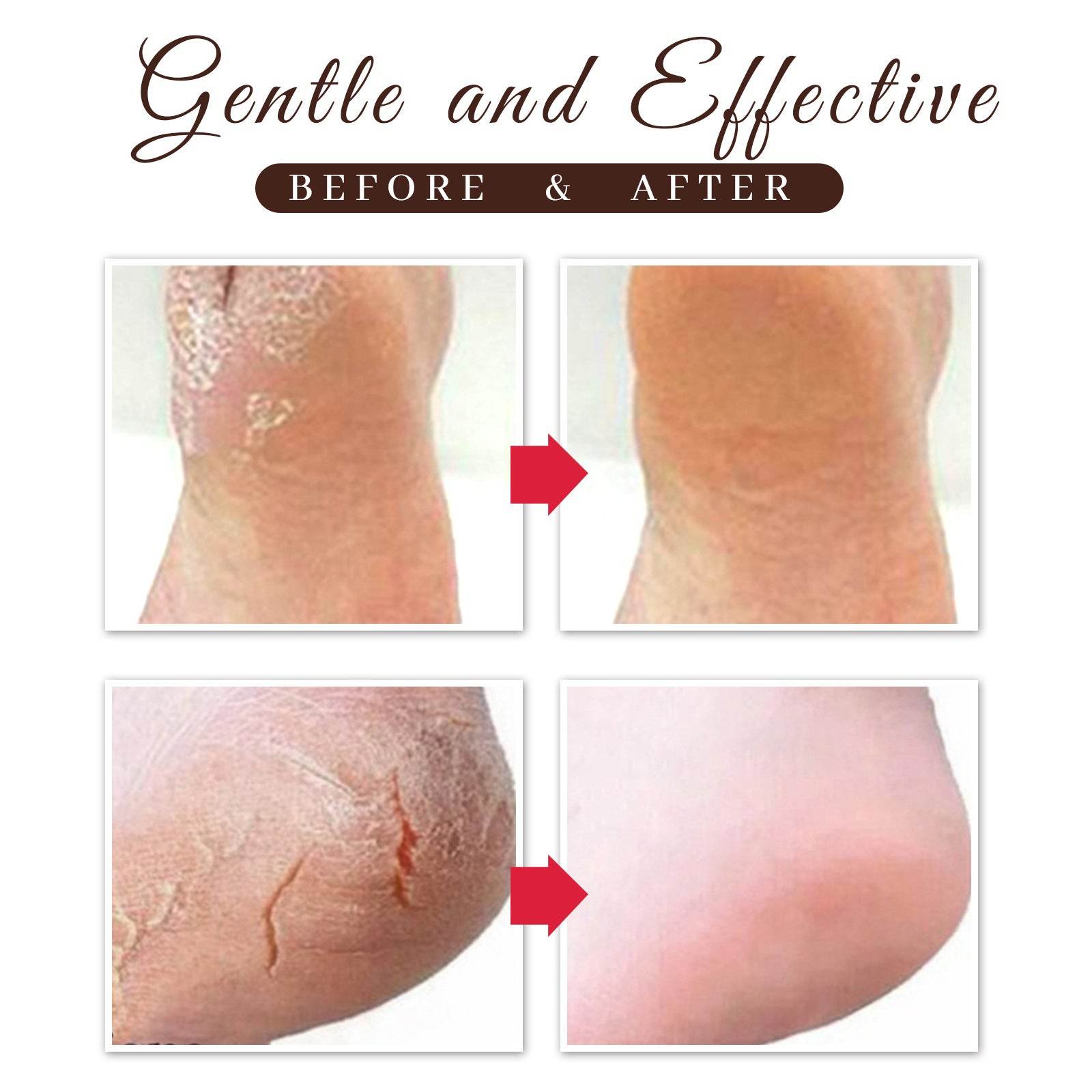 Horse Oil Foot Repair Cream For Dry And Peeling Feet - Mubimart