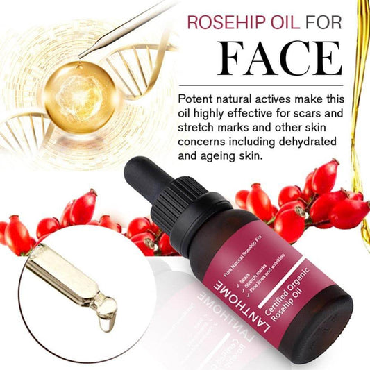 Moisturizing and moisturizing rosehip oil - Mubimart