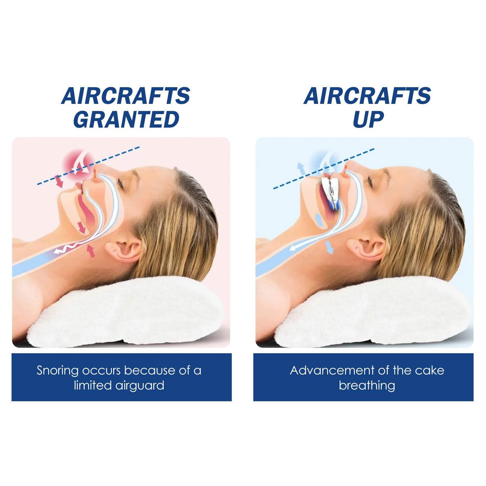 Anti-snoring Teeth Brace Anti-snoring Anti-grinding Breathing Smooth Braces - Mubimart