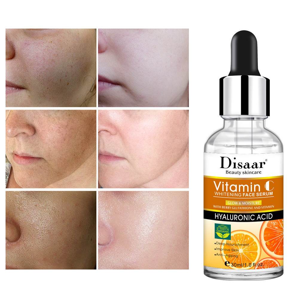 Hyaluronic Acid Vitamin C Face Serum Whitening - Mubimart