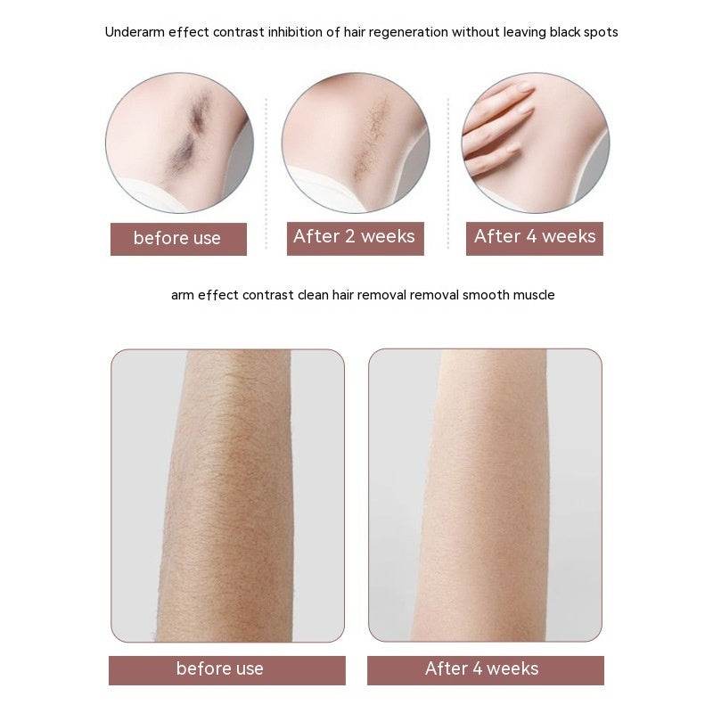 Women Hair Remover Household Men's And Women's Lady Shaver Painless Freezing Point Depilator - Mubimart