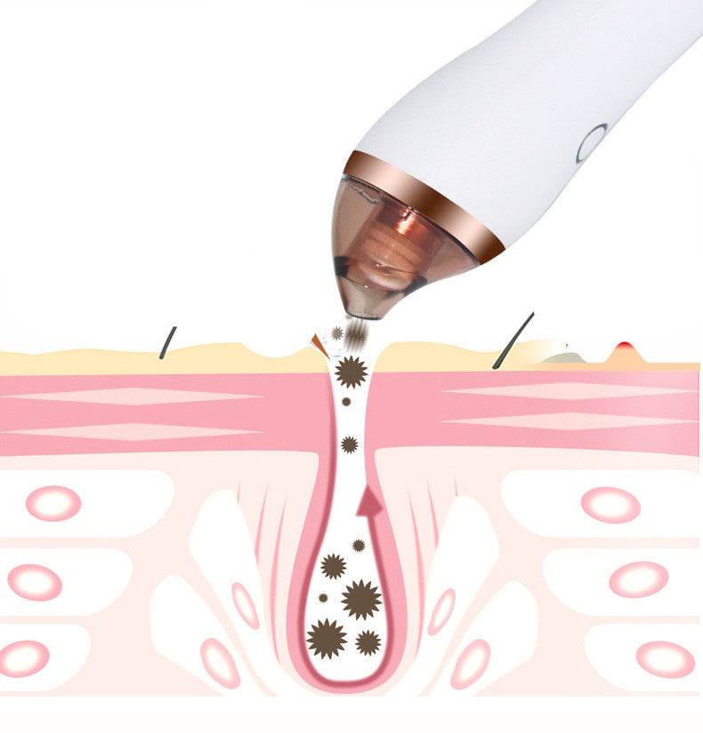 4 in 1 Body Guasha Cupping Blackhead Remover Machine Facial Pore Deep Cleansing Beauty Skin Care - Mubimart