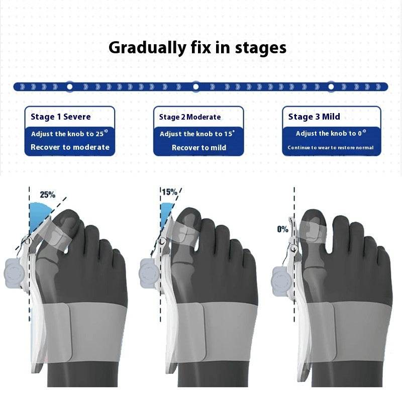 Toe Rectifier Thumb Valgus Toe Separator - Mubimart