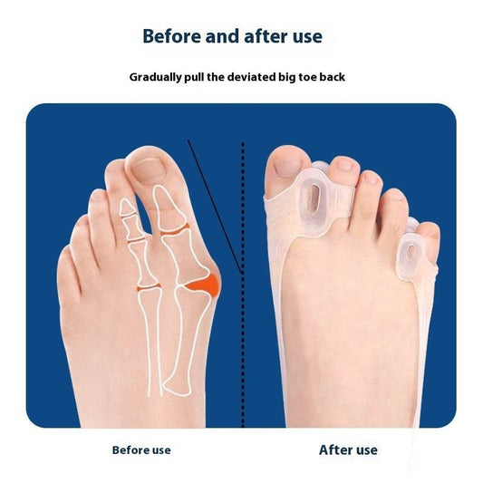 Thumb Valgus Tension Band Double Hole Big Foot Bone Overlapping Toe Toe Separator - Mubimart