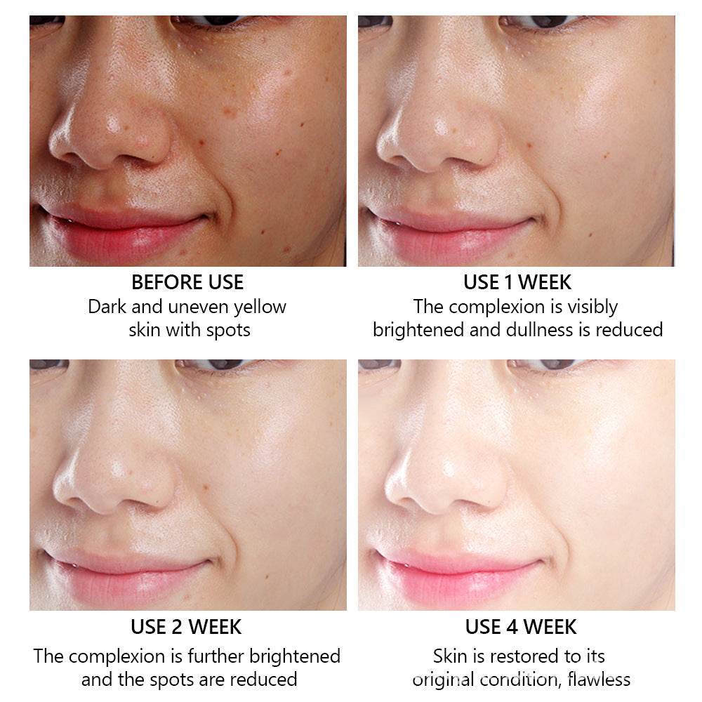 Women's Fashion Vitamin C Facial Serum - Mubimart