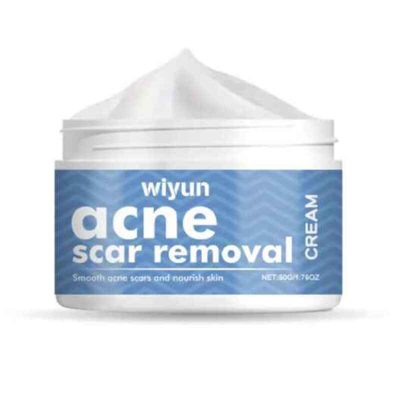 Acne Creams