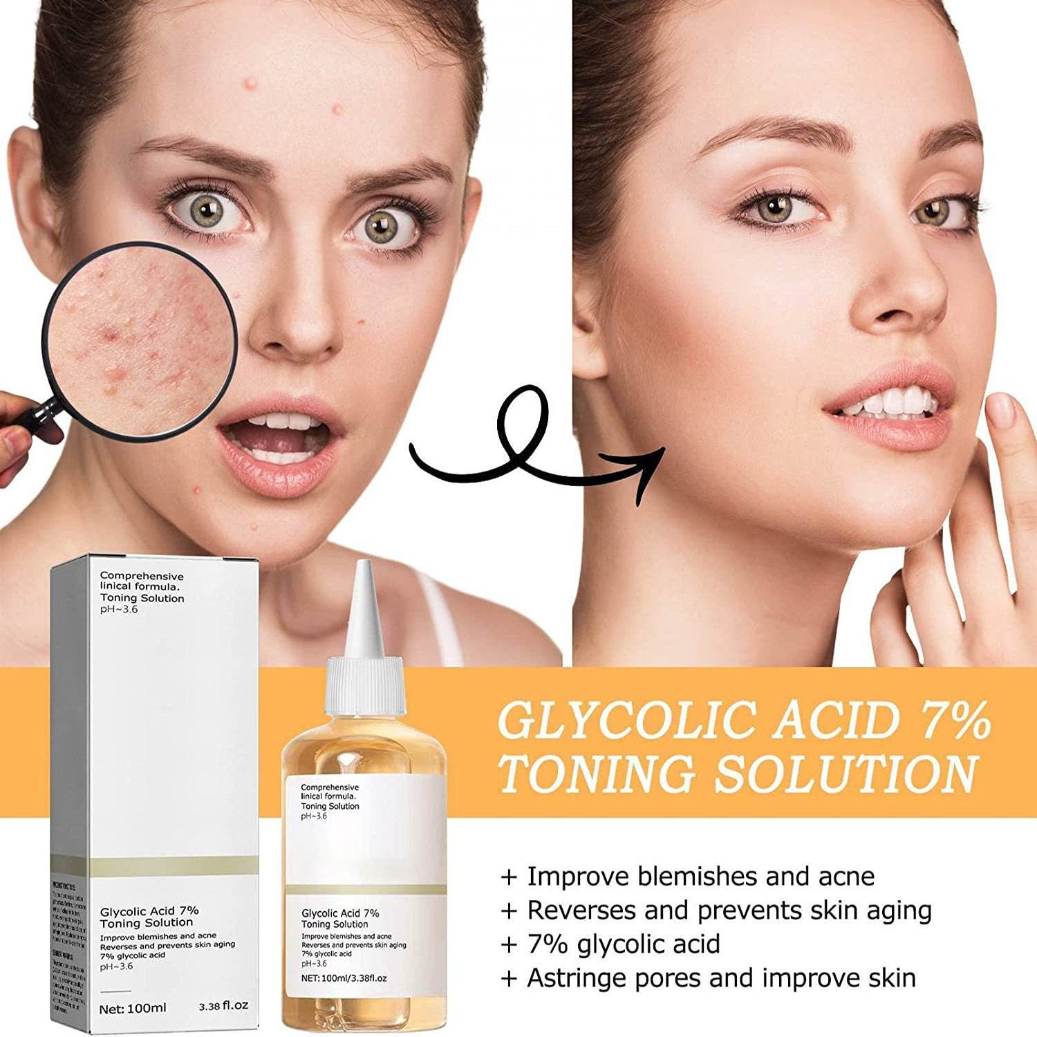 Anti-closed Acne Skin Moisturizing And Skin Rejuvenation Lotion - Mubimart