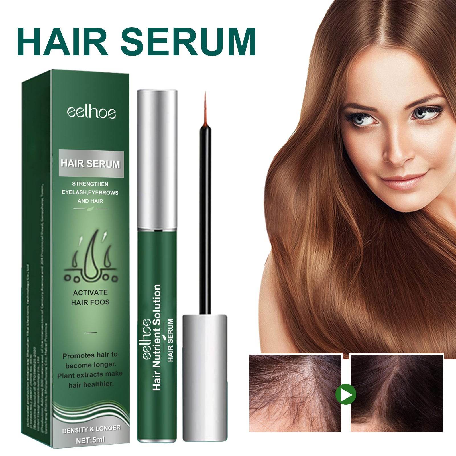 Anti-hair Loss Mild Hair Root Strong Plant Care Prime - Mubimart