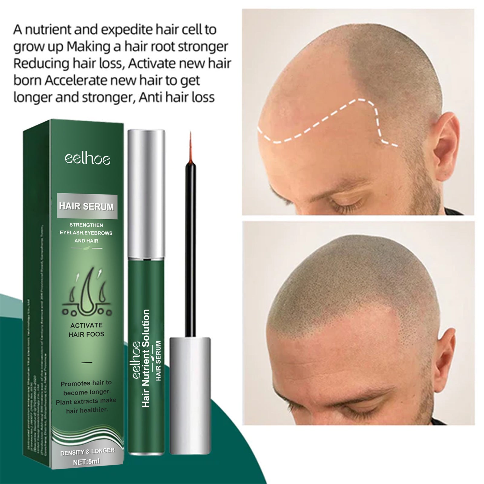 Anti-hair Loss Mild Hair Root Strong Plant Care Prime - Mubimart -  