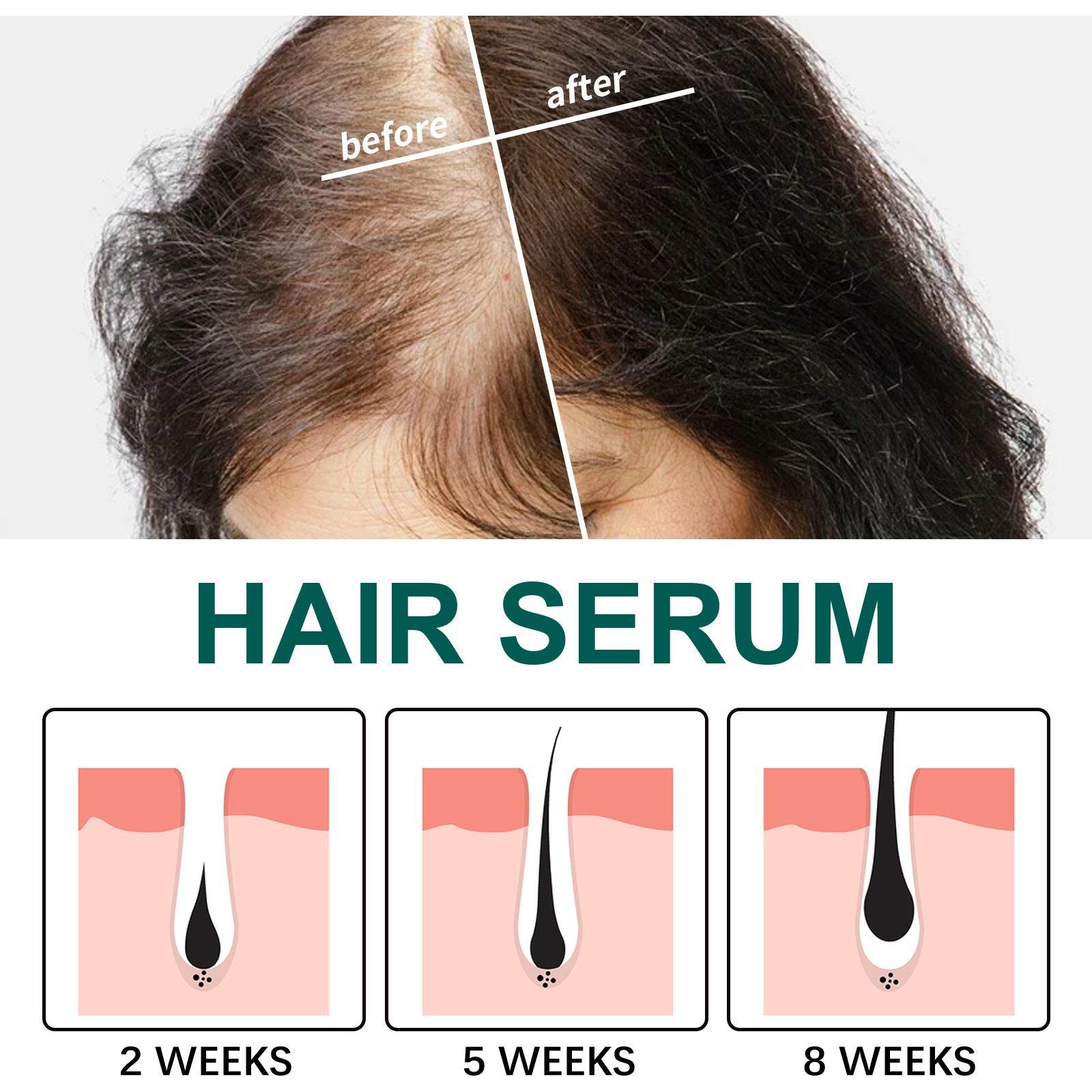 Anti-hair Loss Mild Hair Root Strong Plant Care Prime - Mubimart