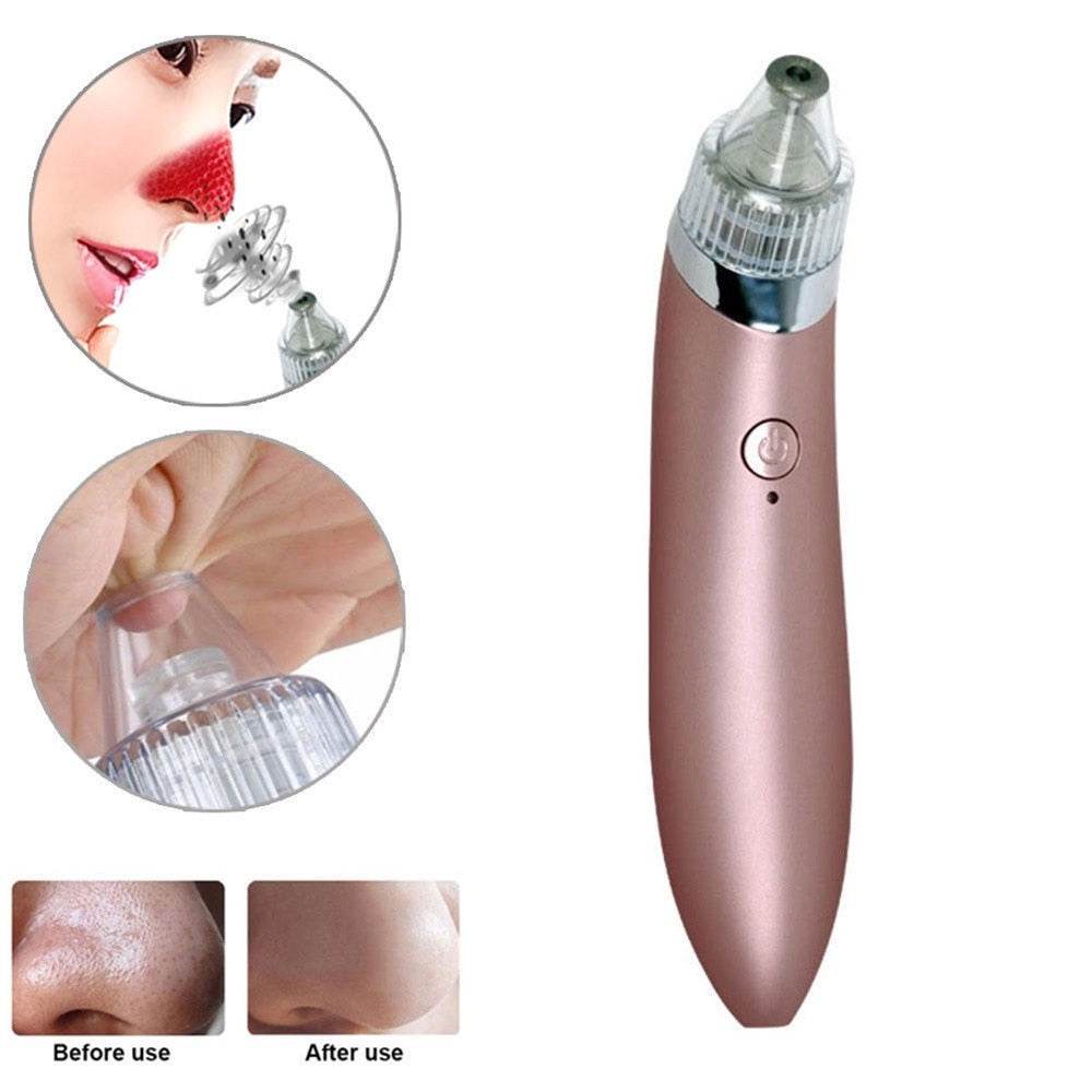 Beauty facial machine - Mubimart