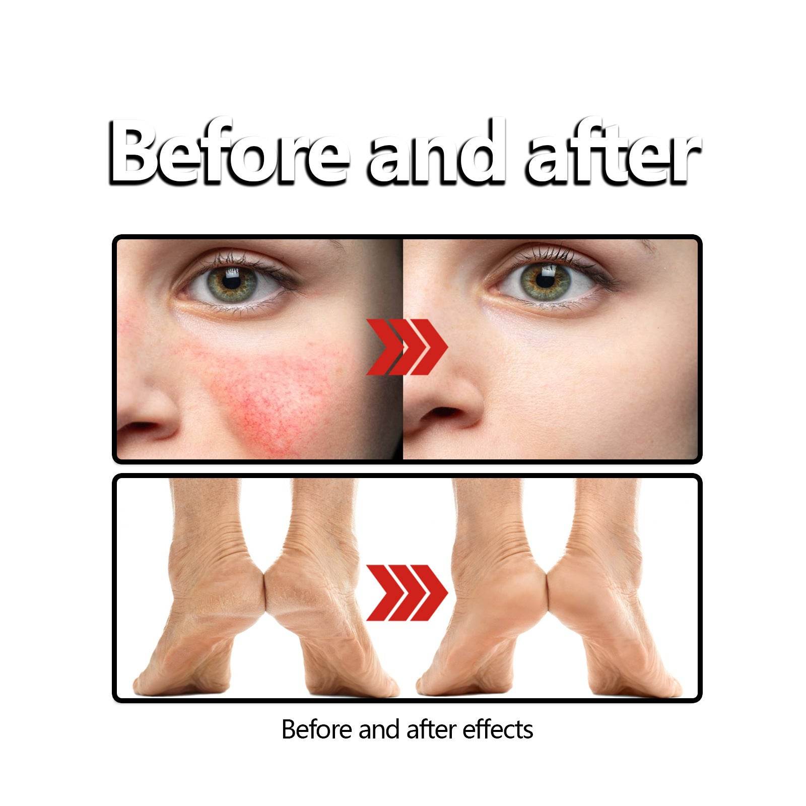 Beeswax Skin Cream Relieves Sunscreen Anti-itch Ointment - Mubimart