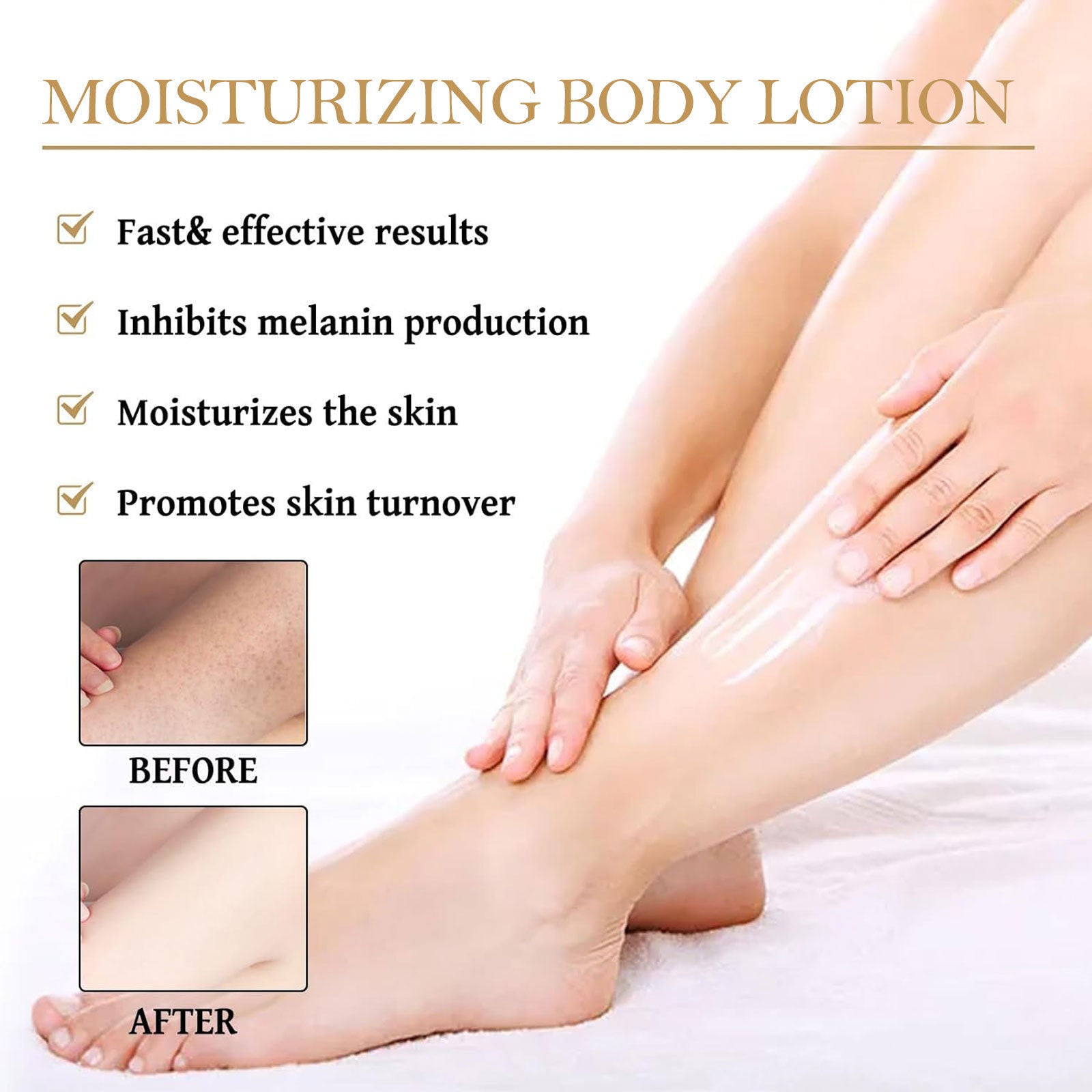 Brightening Moisturizing Body Lotion Repair Chicken Skin Anti-drying - Mubimart -  