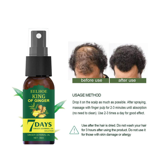 EELHOE Foreign Trade Cross-border Ginger Nutrition Spray Ginger Hair Root Spray Moisturizing Hair Hair Care Spray Spray - Mubimart