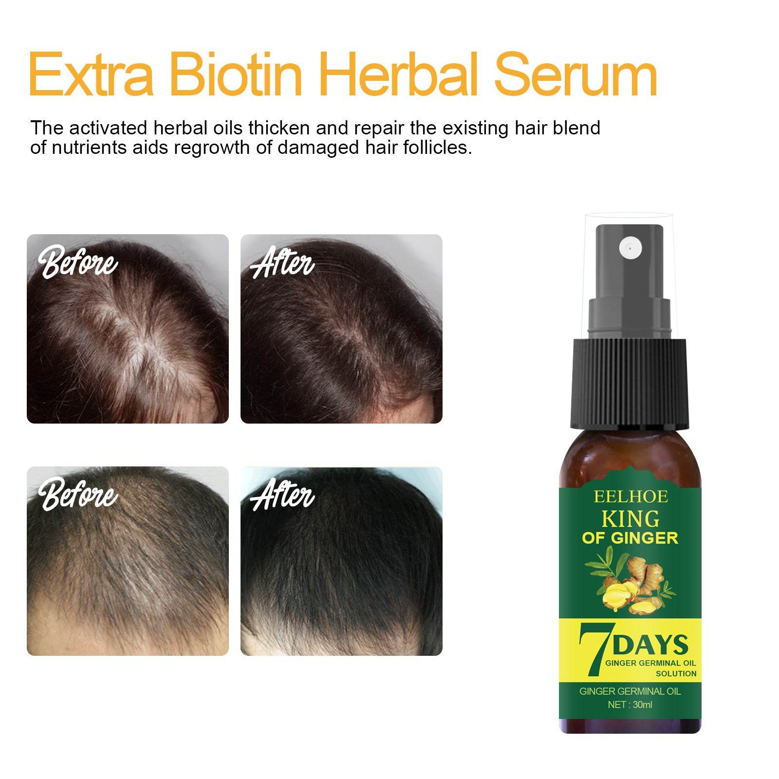 EELHOE Foreign Trade Cross-border Ginger Nutrition Spray Ginger Hair Root Spray Moisturizing Hair Hair Care Spray Spray - Mubimart