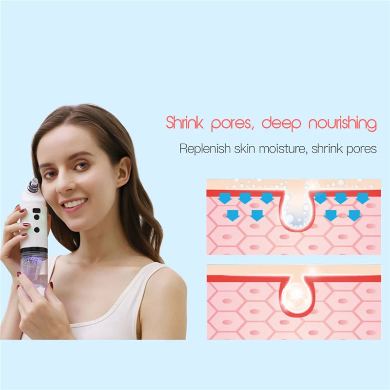 Electric Facial Cleaning Vacuum Cleaner Blackhead Ance Remover Shrink Pores Hydrating Face Skin Care Peeling Device - Mubimart -  