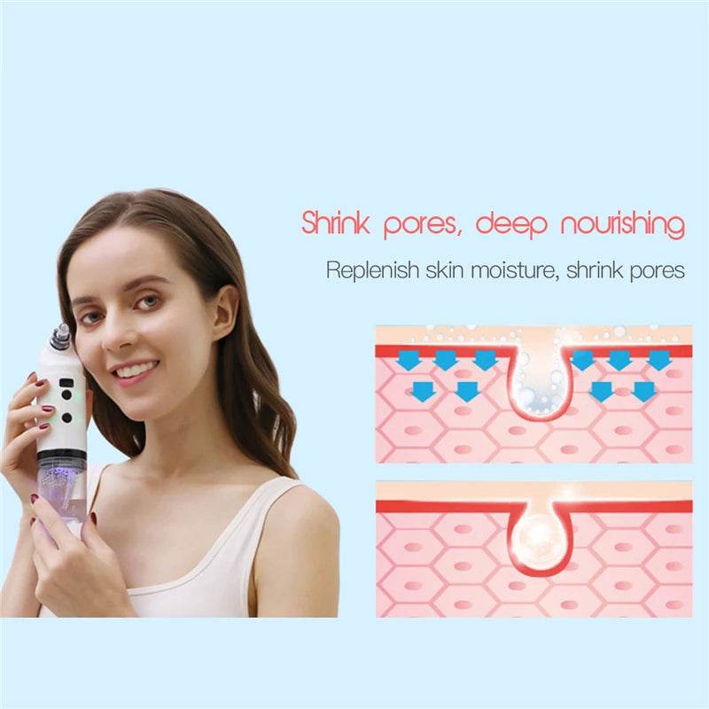 Electric Facial Cleaning Vacuum Cleaner Blackhead Ance Remover Shrink Pores Hydrating Face Skin Care Peeling Device - Mubimart
