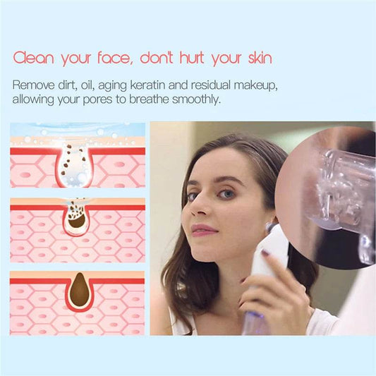 Electric Facial Cleaning Vacuum Cleaner Blackhead Ance Remover Shrink Pores Hydrating Face Skin Care Peeling Device - Mubimart