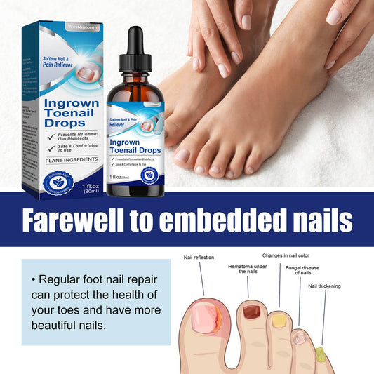 Embedded Nail Repair Skin Moisturizing Lotion - Mubimart