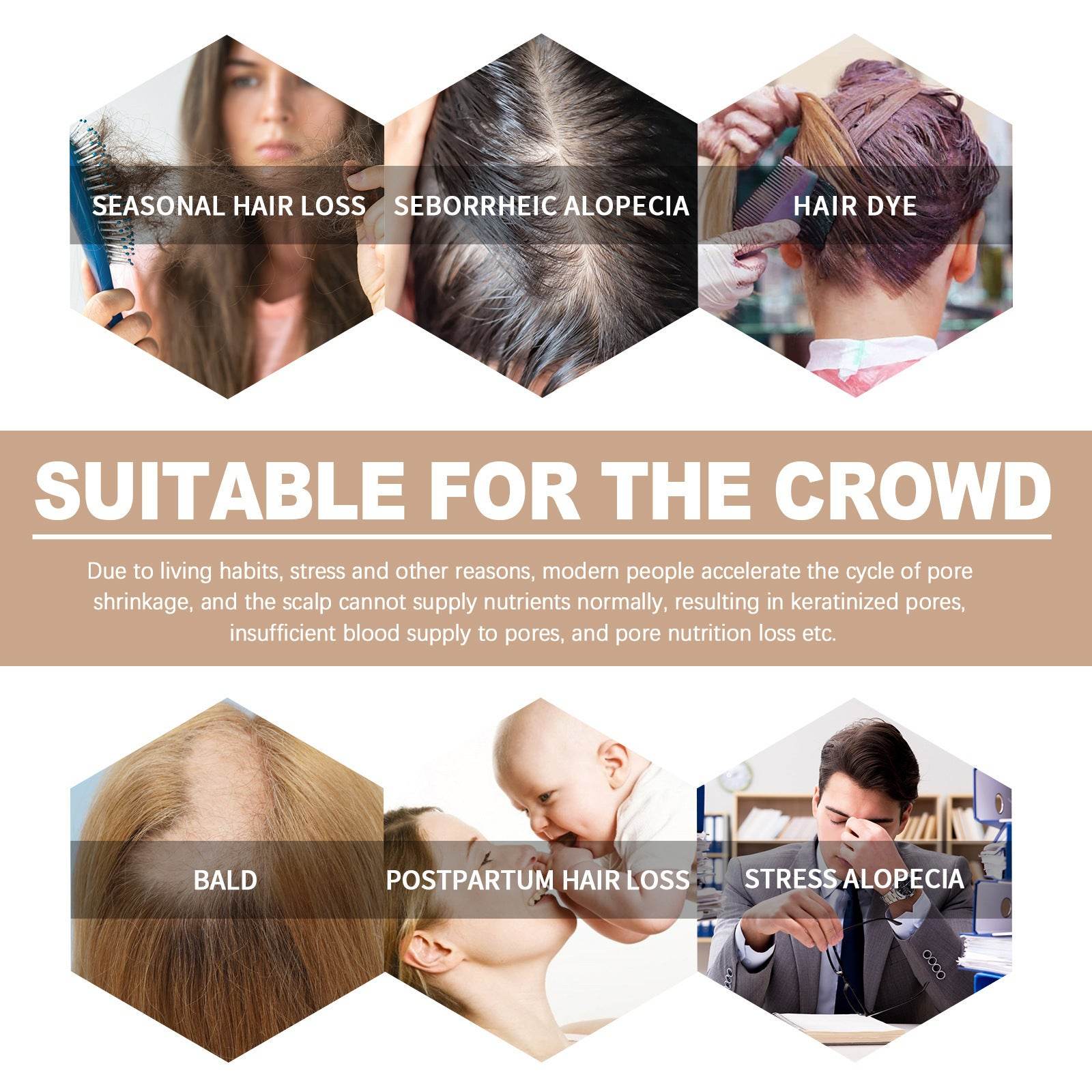 Essential Oil Improves Dry And Manic Hair Loss Prevention - Mubimart
