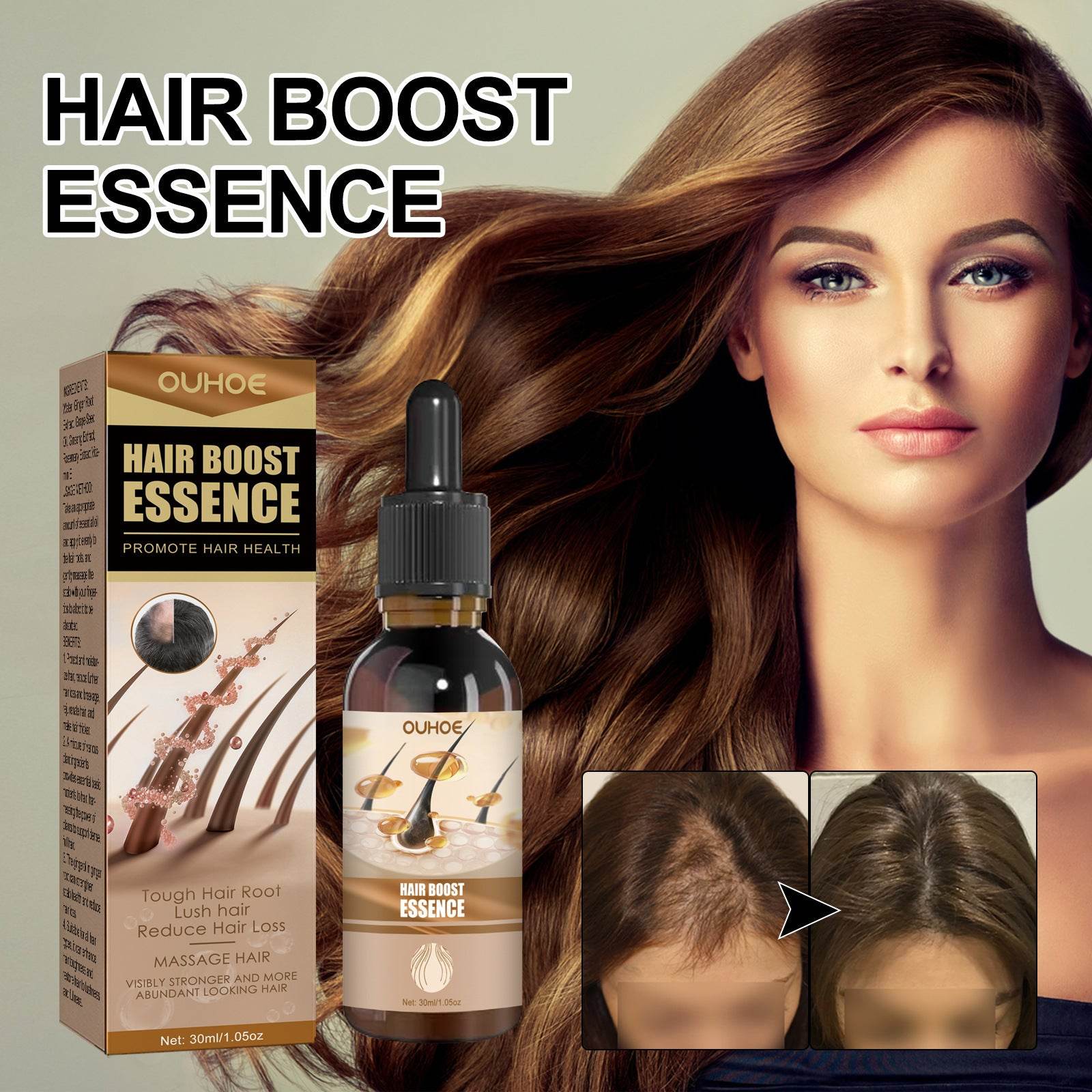 Essential Oil Improves Dry And Manic Hair Loss Prevention - Mubimart