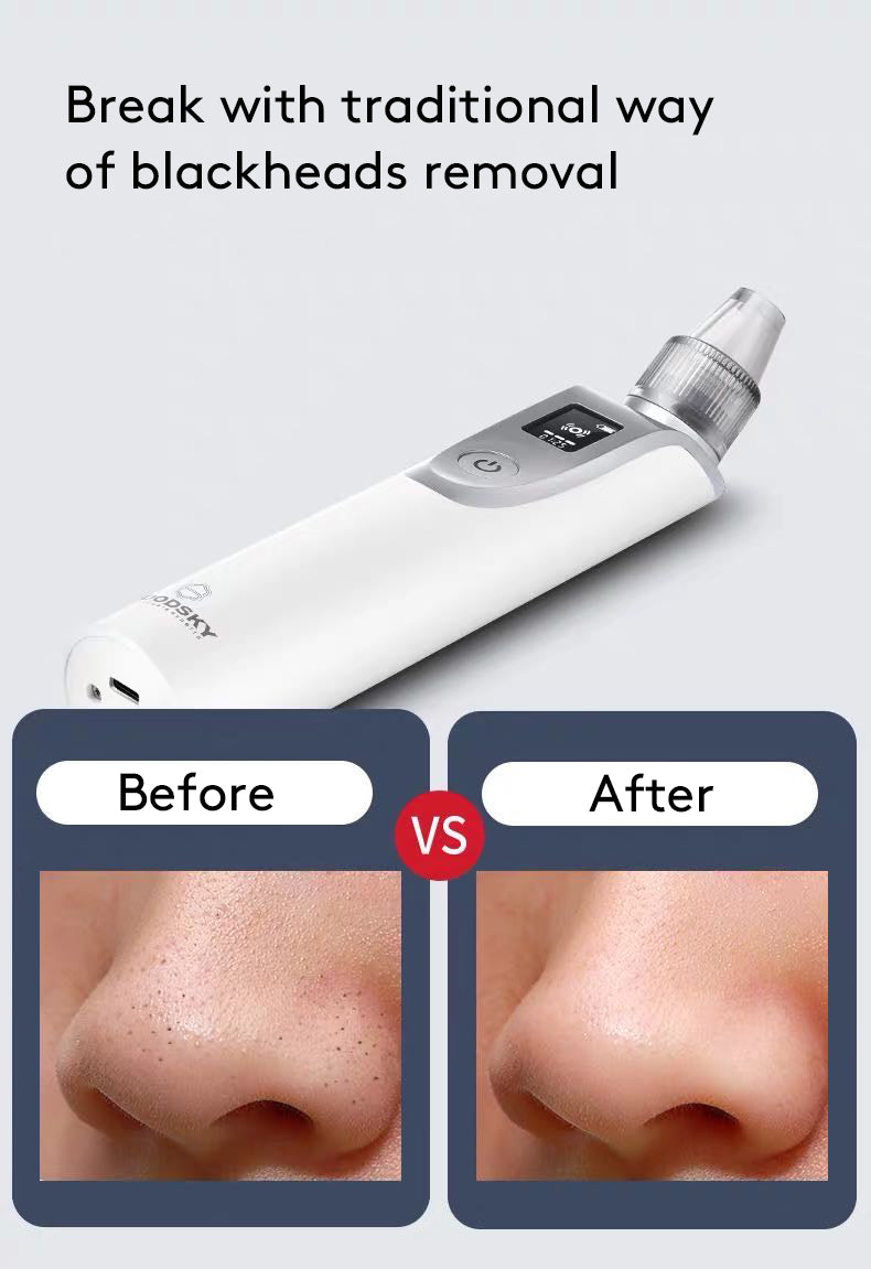 Facial Blackhead Cleaning Instrument - Mubimart -  