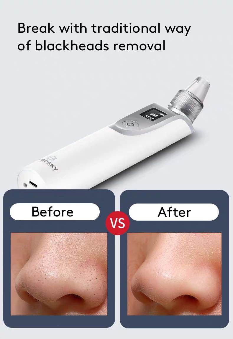 Facial Blackhead Cleaning Instrument - Mubimart