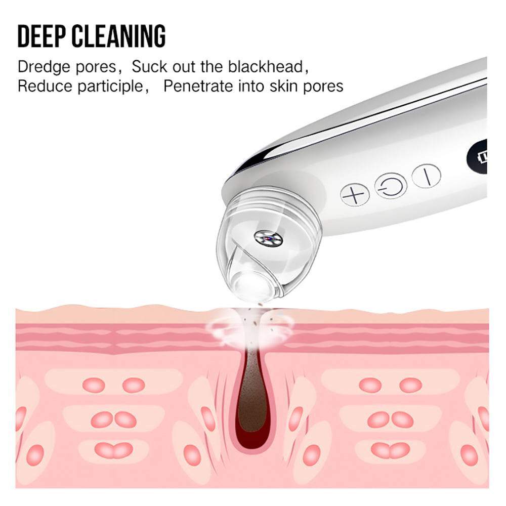 Facial Blackhead Remover - Mubimart
