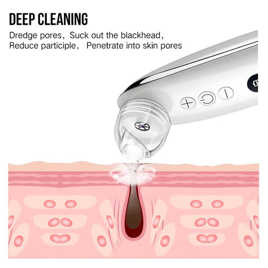 Facial Blackhead Remover - Mubimart