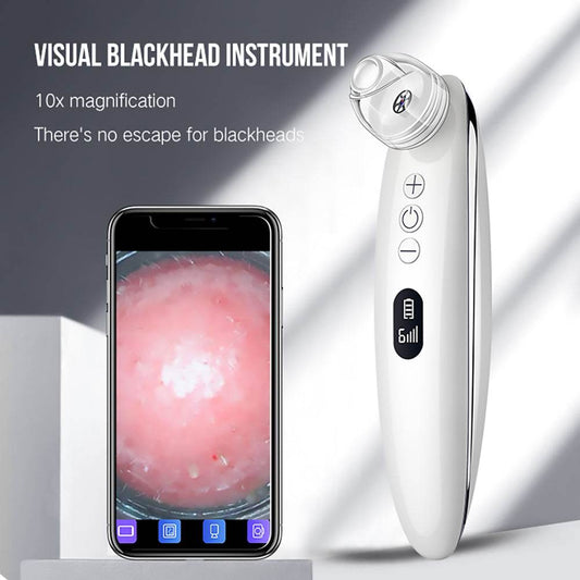 Facial Blackhead Remover - Mubimart