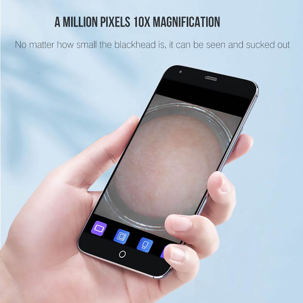 Facial Blackhead Remover - Mubimart