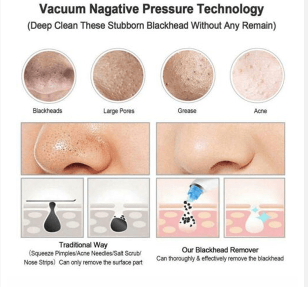 Facial Pore Cleaner - Mubimart