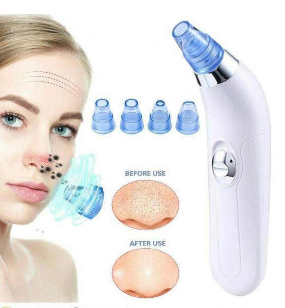 Facial Pore Cleaner - Mubimart -  