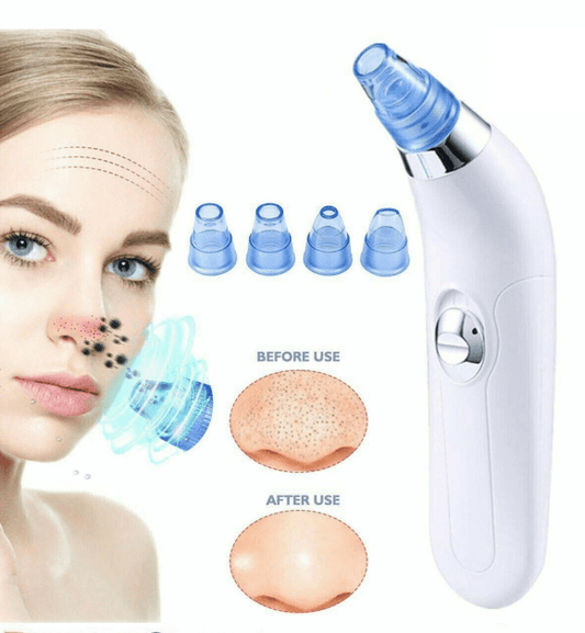 Facial Pore Cleaner - Mubimart