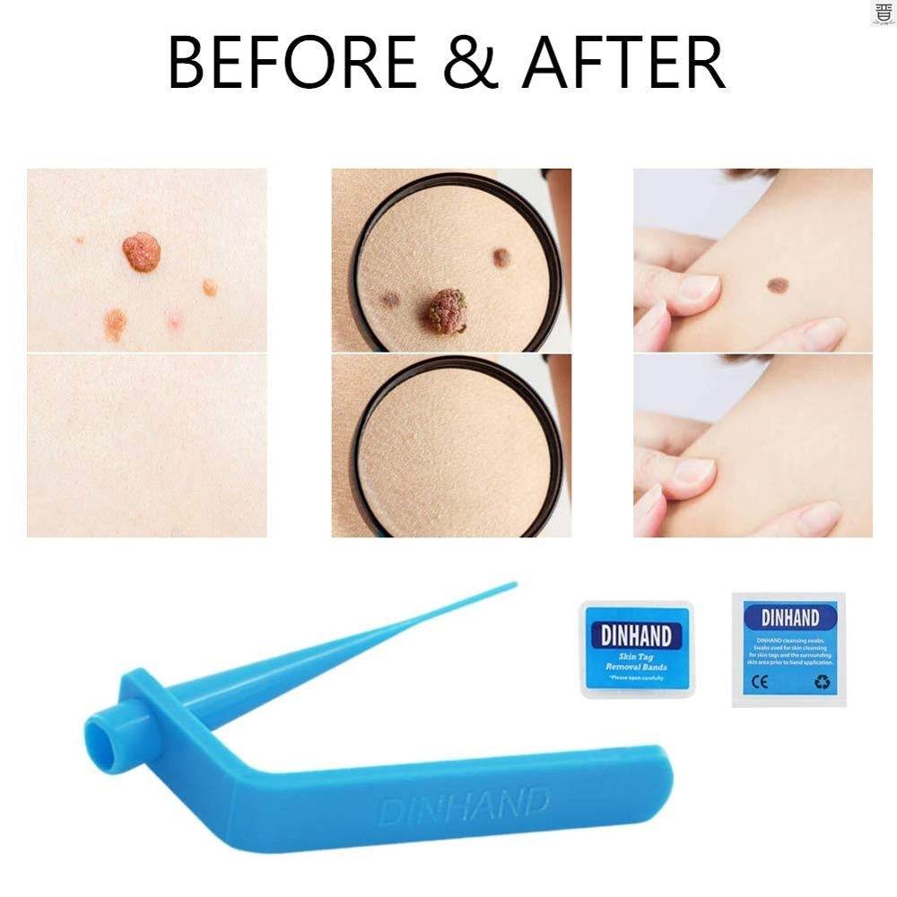 Facial care beauty tools - Mubimart