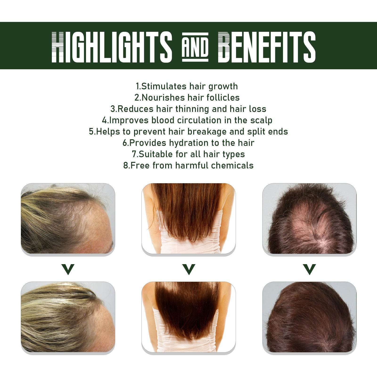 Ginger Dense Hair Spray Nourishing Hair Follicle Anti-hair Loss - Mubimart