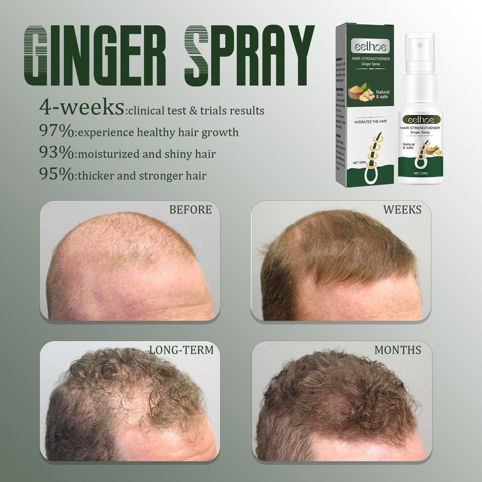 Ginger Dense Hair Spray Nourishing Hair Follicle Anti-hair Loss - Mubimart - Hair Spary 