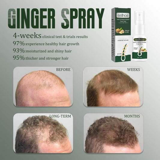 Ginger Dense Hair Spray Nourishing Hair Follicle Anti-hair Loss - Mubimart
