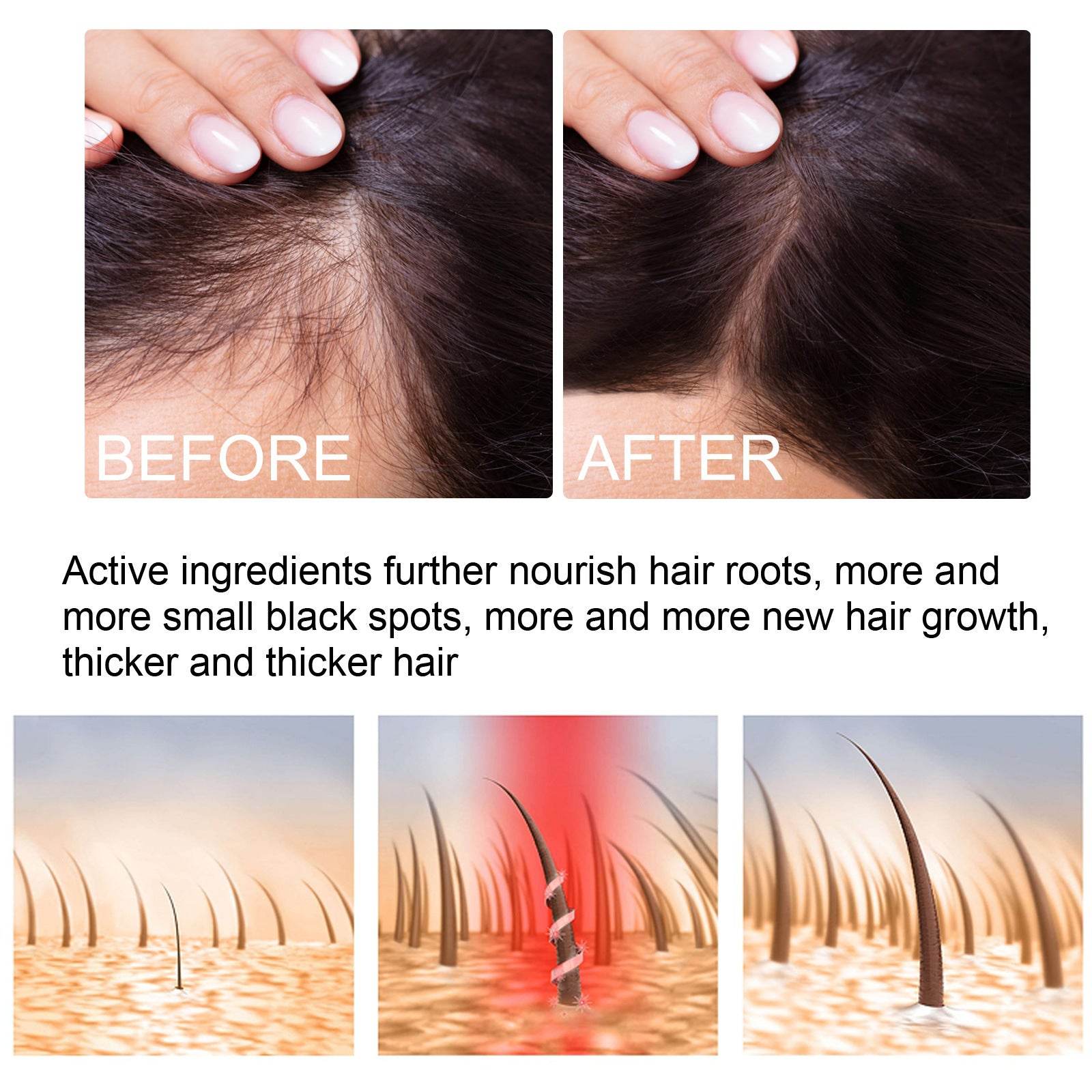 Ginger Hair Growth Moisturizing Nutrition Spray - Mubimart