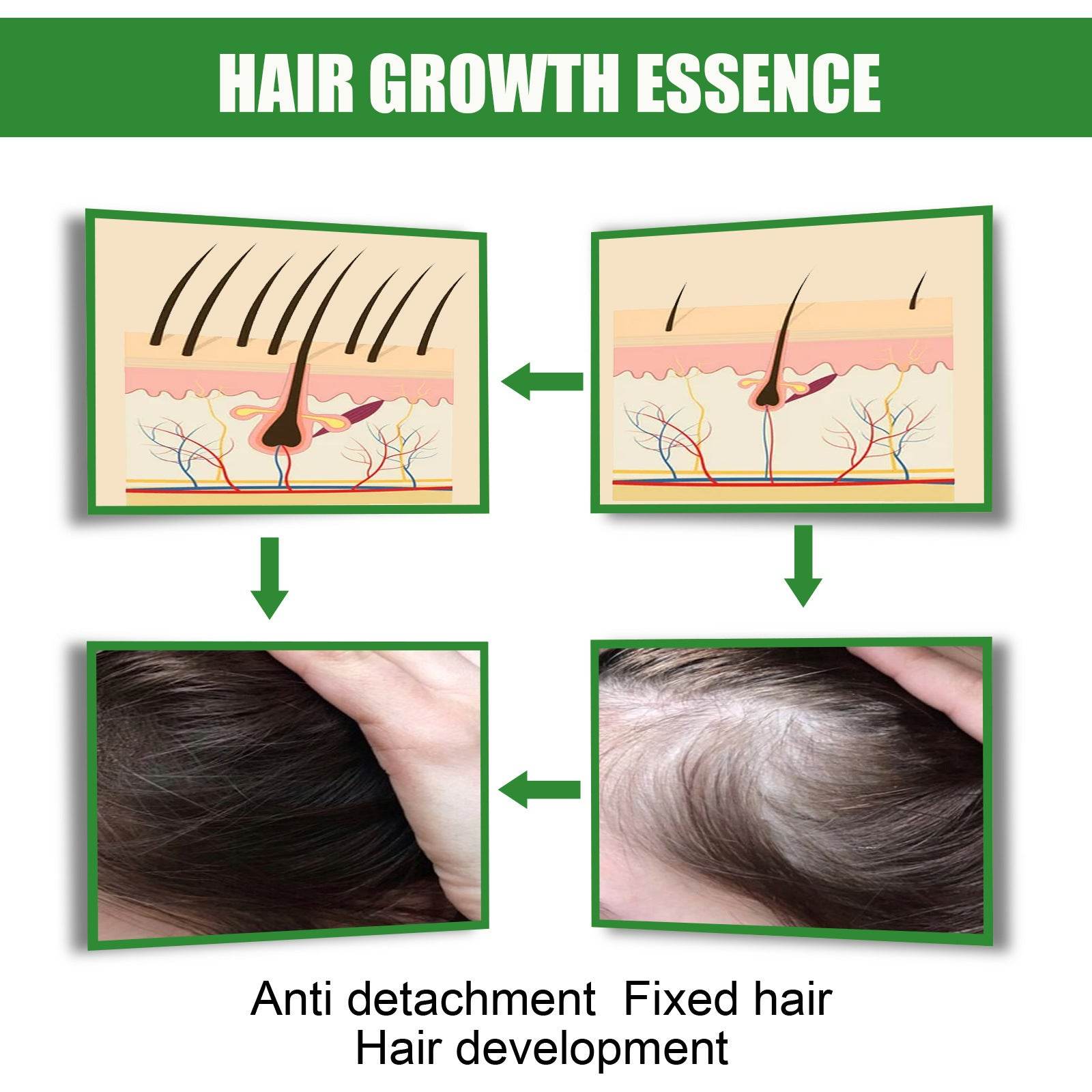 Ginger Hair Growth Moisturizing Nutrition Spray - Mubimart