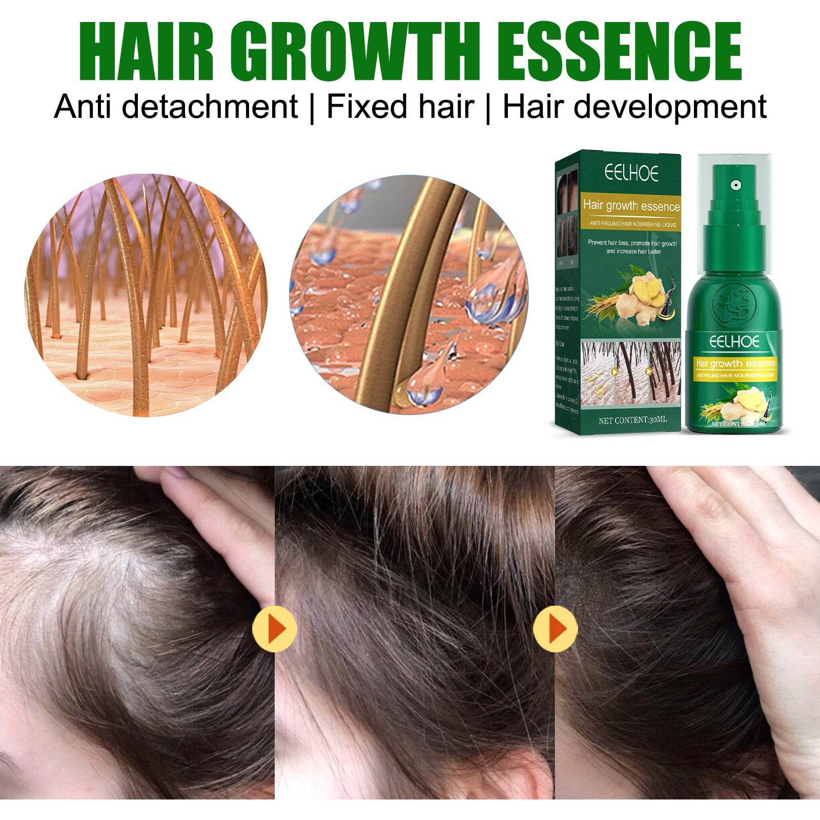 Ginger Hair Growth Moisturizing Nutrition Spray - Mubimart