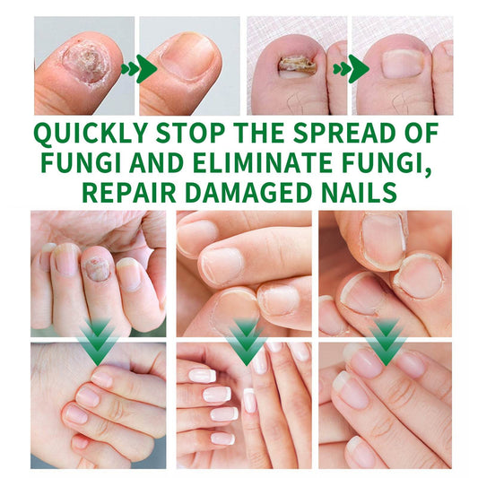 Ginger Nail Care Lotion Repair Hand And Foot Moisturizing - Mubimart