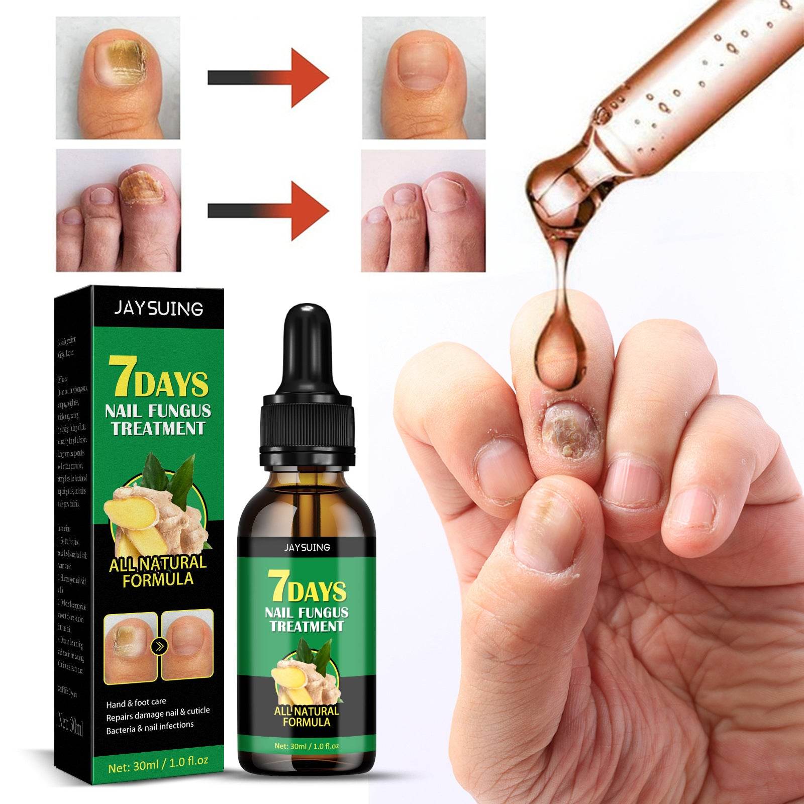 Ginger Nail Care Lotion Repair Hand And Foot Moisturizing - Mubimart