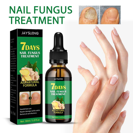 Ginger Nail Care Lotion Repair Hand And Foot Moisturizing - Mubimart