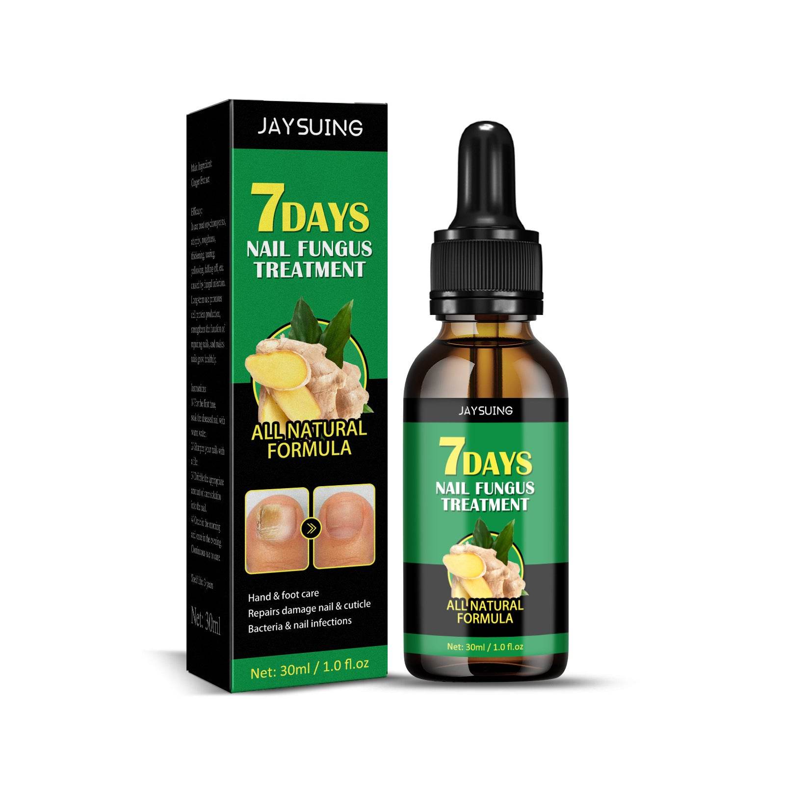 Ginger Nail Care Lotion Repair Hand And Foot Moisturizing - Mubimart